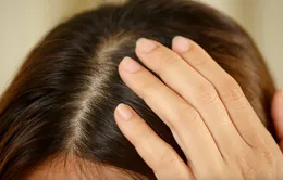 Những yếu tố gây ra tóc bạc