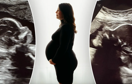 Kỳ lạ người phụ nữ có hai tử cung mang thai đôi, mỗi tử cung một thai nhi