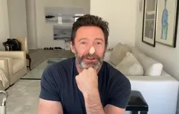 "Người sói" Hugh Jackman tiết lộ nỗi sợ ung thư da, kêu gọi người hâm mộ bôi kem chống nắng