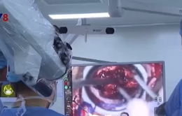 Lần đầu tiên Việt Nam ứng dụng robot phẫu thuật u não