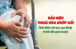 Dấu hiệu thoái hóa khớp gối - Thời điểm tái tạo sụn khớp trước khi quá muộn