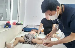 Đắk Lắk: Gia tăng tình trạng trẻ mắc tay chân miệng thể nặng