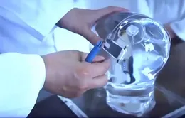 Thiết bị hỗ trợ điều trị bệnh nhân mắc chứng động kinh