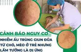 Cảnh báo nguy cơ nhiễm ấu trùng giun đũa từ chó, mèo ở trẻ