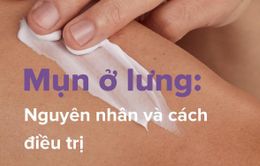 Mụn ở lưng: Nguyên nhân và cách điều trị