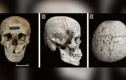Bí ẩn về những hộp sọ Nhật Bản cổ đại bị “biến dạng”