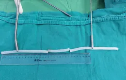 Rối loạn hành vi: Người đàn ông nhét keo nến vào niệu đạo để tạo khoái cảm
