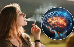 Hút thuốc làm teo não và tăng nguy cơ mắc bệnh Alzheimer