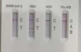 Nhiều trẻ trở nặng do nhiễm virus hợp bào hô hấp RSV