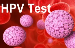 Bộ dụng cụ tự sàng lọc giúp phụ nữ Thái Lan tự xét nghiệm HPV