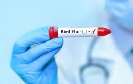 Ca nhiễm virus H5N2 tử vong do nhiều yếu tố