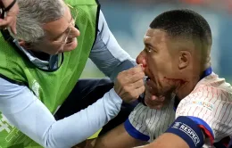 Mbappé đang gặp khó khăn với việc thay đổi mặt nạ liên tục trong các trận đấu