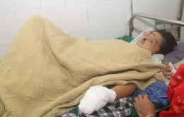Bé trai bị dập nát bàn tay trái khi sử dụng điện thoại đang sạc pin