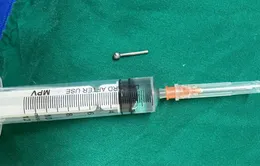 Nhiều trường hợp nhập viện vì mắc dị vật tiêu hóa