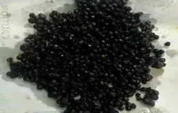 Cắt túi mật chứa hơn 500 viên sỏi cho bệnh nhân