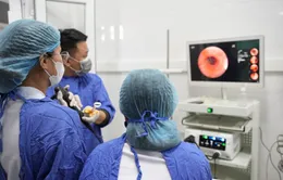 Nội soi gắp hạt hồng xiêm khỏi phế quản cụ bà 75 tuổi
