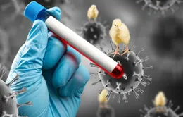 Bé gái viêm não do virus cúm gia cầm H5N1