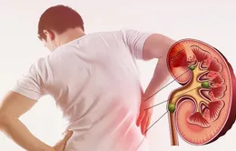 Cảnh báo rủi ro nghiêm trọng đối với sức khỏe xuất phát từ các vấn đề về thận