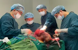 Quảng Bình: Phẫu thuật thành công khối u dị dạng mạch máu hiếm gặp vùng mặt