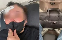 Dùng gậy sắt chọc vào mặt người phụ nữ do mâu thuẫn giao thông ở Hà Nội