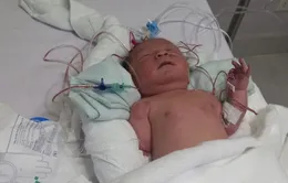 Giấc mơ lớn lên còn dang dở vì trái tim không lành lặn của bệnh nhi 2 tháng tuổi