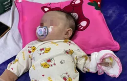 Cảnh giác với bệnh ho gà: Trẻ nhỏ dễ nguy kịch nếu không tiêm phòng