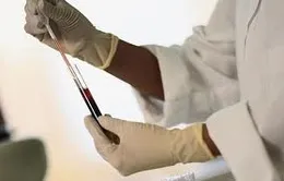 Thử máu giúp chuẩn đoán nguy cơ đau tim