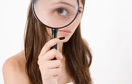 Cách chữa lên chắp ở mắt