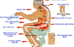 Những nguy cơ khó khó lường khi ngồi nhiều