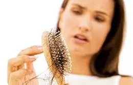 Rụng tóc sau sinh: Nỗi lo của nhiều bà mẹ