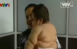 Colombia: Bé trai 8 tháng tuổi nặng... 20kg