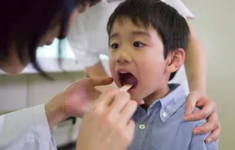 Cách chăm sóc trẻ bị ho dị ứng