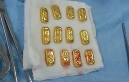 Phát hiện 12 thỏi vàng trong bụng doanh nhân Ấn Độ