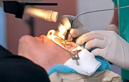 Giác mạc mỏng, thoái hóa võng mạc có nên mổ cận thị?