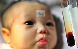 Những trường hợp nên đưa trẻ đi xét nghiệm máu