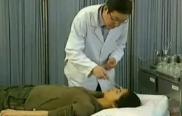 Châm cứu chữa khô mắt hiệu quả