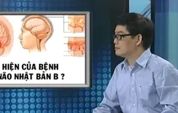 Các biểu hiện của bệnh viêm não Nhật Bản B