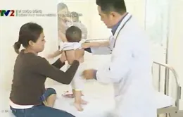 Mùa hè, phụ huynh lo lắng trẻ mắc tay chân miệng
