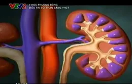 Chữa sỏi thận bằng y học cổ truyền