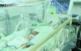 Cách chăm sóc trẻ sinh non tháng, nhẹ cân
