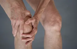 Phòng thoái hóa khớp được không?