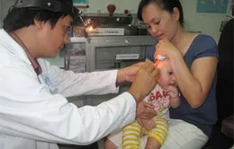 Cách nhận biết và xử trí viêm tai giữa ở trẻ nhỏ