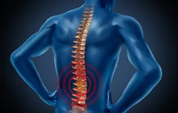 Kết hợp nhiều phương pháp trong điều trị bệnh lý cột sống 