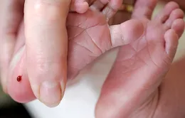 Nâng cao sàng lọc trước sinh và sàng lọc sơ sinh