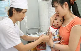 Bệnh thủy đậu: Ðiều trị đúng để tránh biến chứng