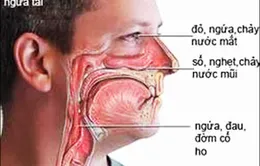 Cẩn thận với những bệnh dị ứng hay gặp