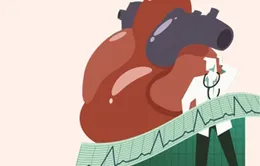 Cấp cứu người cao tuổi: Làm sao cho đúng?