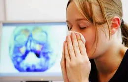 Bài thuốc điều trị viêm xoang hiệu quả