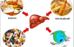 Cần phát hiện và điều trị sớm bệnh gan nhiễm mỡ
