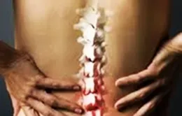 Phòng và điều trị bệnh lý thoái hóa cột sống